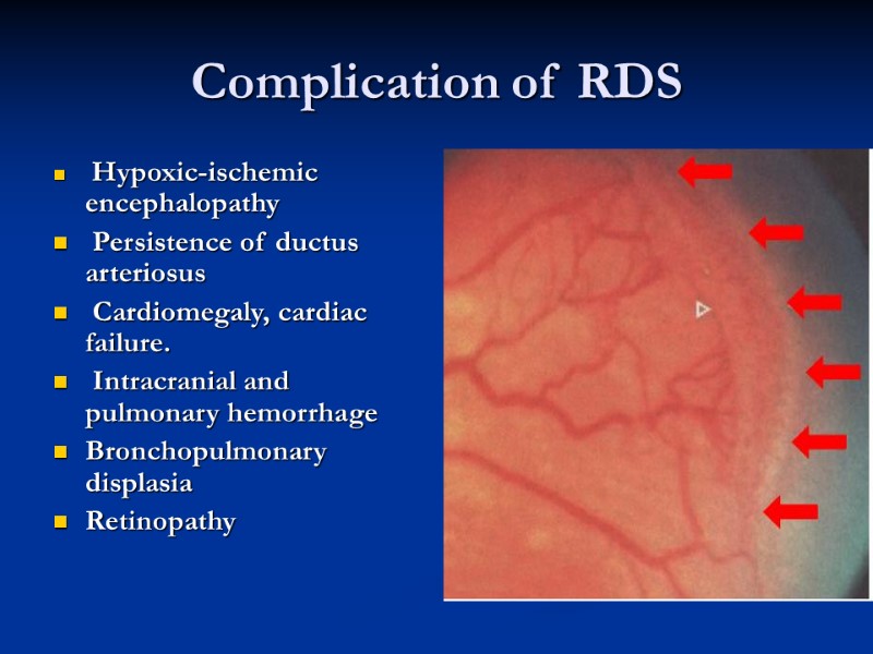 Complication of RDS  Hypoxic-ischemic encephalopathy  Persistence of ductus arteriosus   Cardiomegaly,